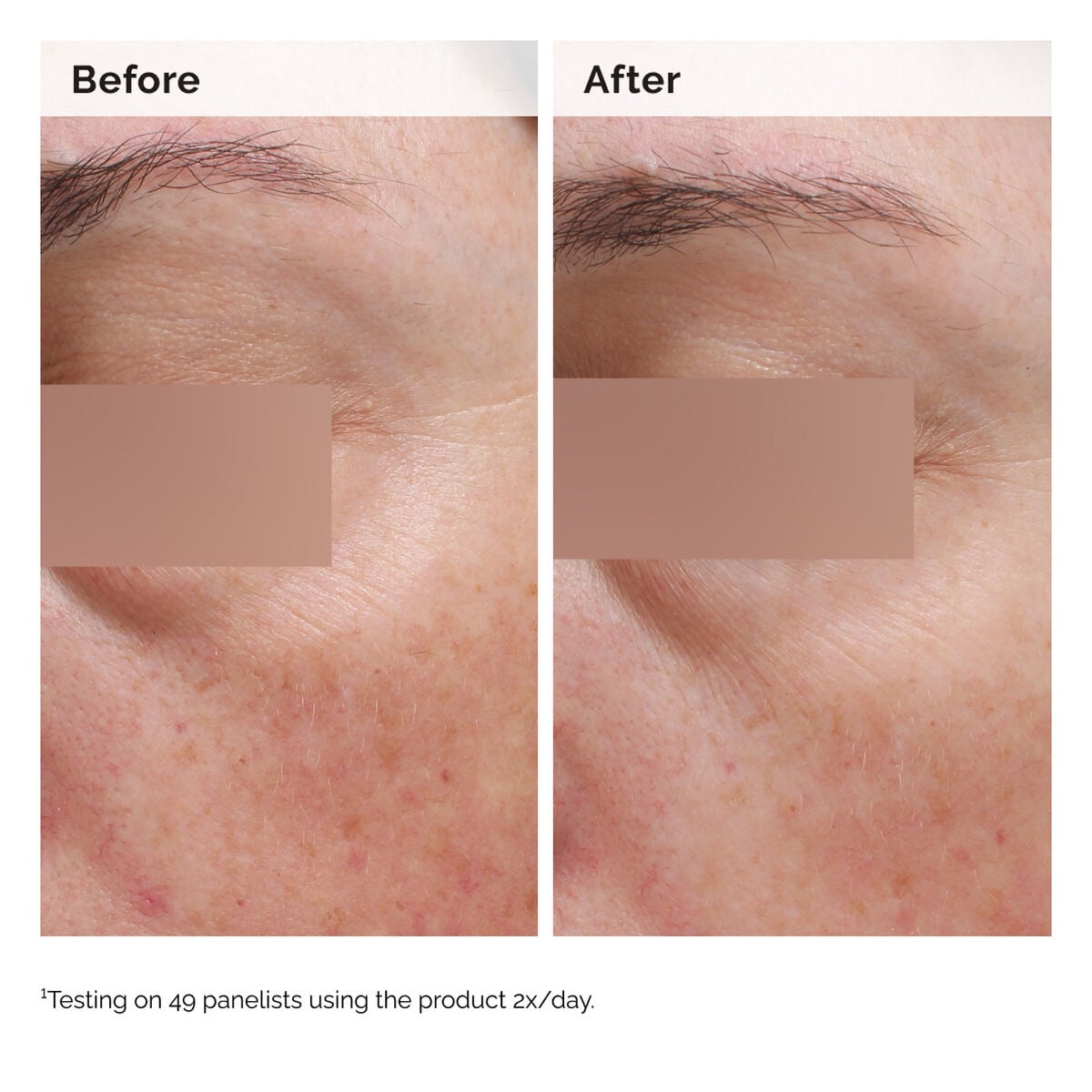 niacinamide-5-face-and-body-emulsion-k9 2024-08-23-ORD-Nia-5pct-Face-Body-B-A-Elasticity-Global-02-1x1.jpg