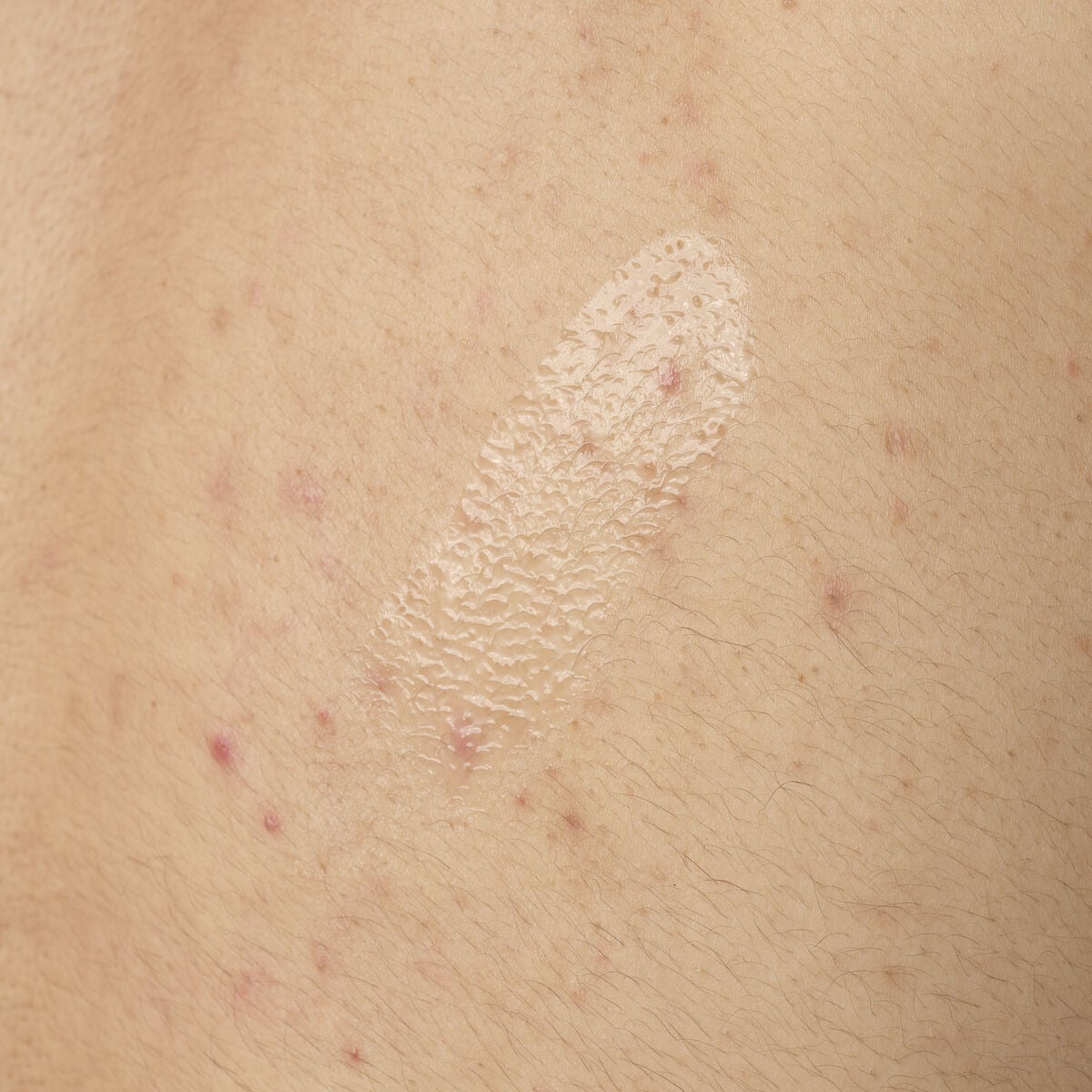 salicylic-acid-0-5-body-serum-m5 ORD-salicylic-acid-05-body-240ml-application.jpg
