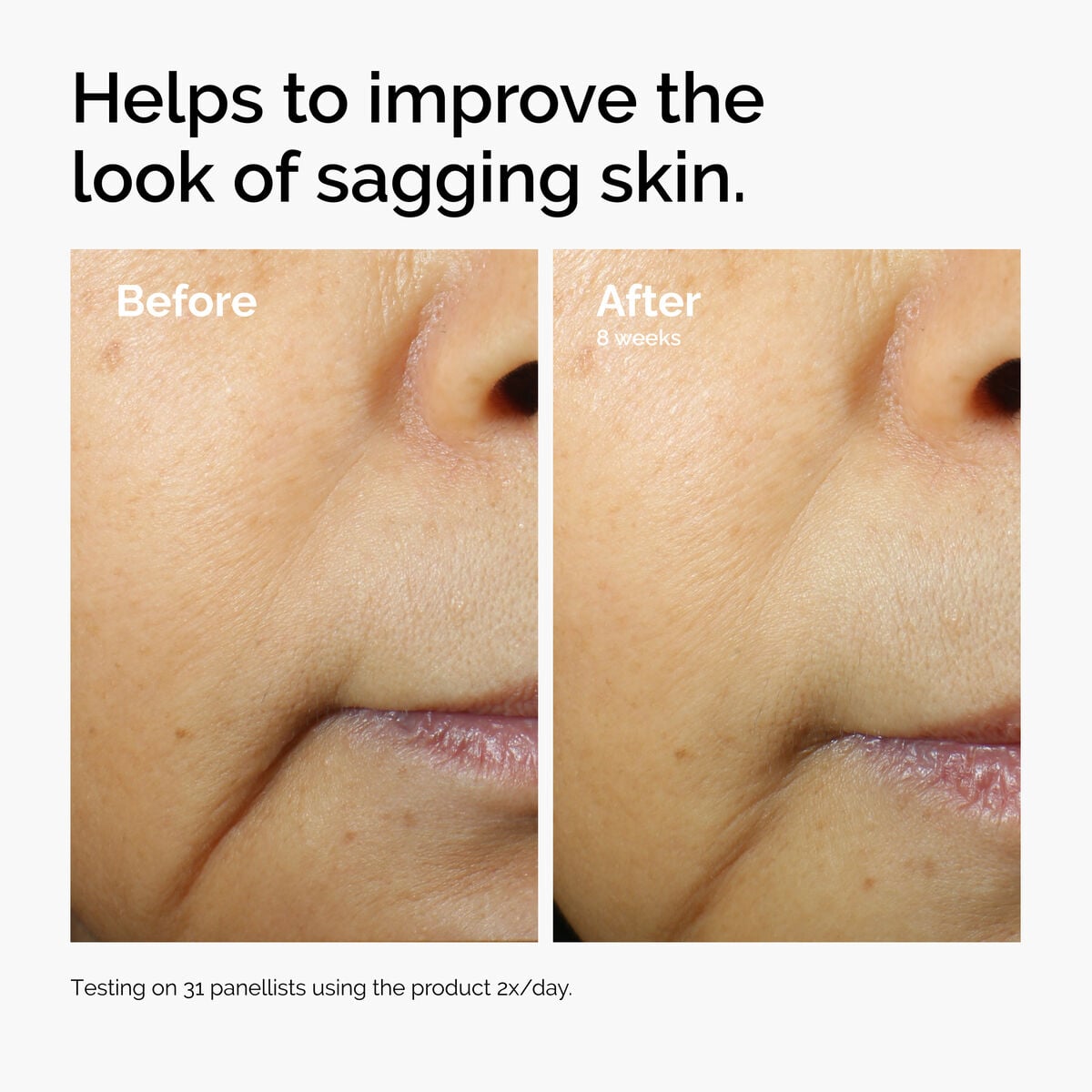 caffeine-3-escin-1-face-serum-h8 ord-caffeine-3pct-escin-1pct-face-serum-before-after-sagging.jpg