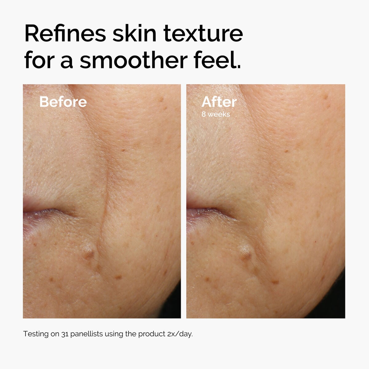 caffeine-3-escin-1-face-serum-h8 ord-caffeine-3pct-escin-1pct-face-serum-before-after-texture.jpg