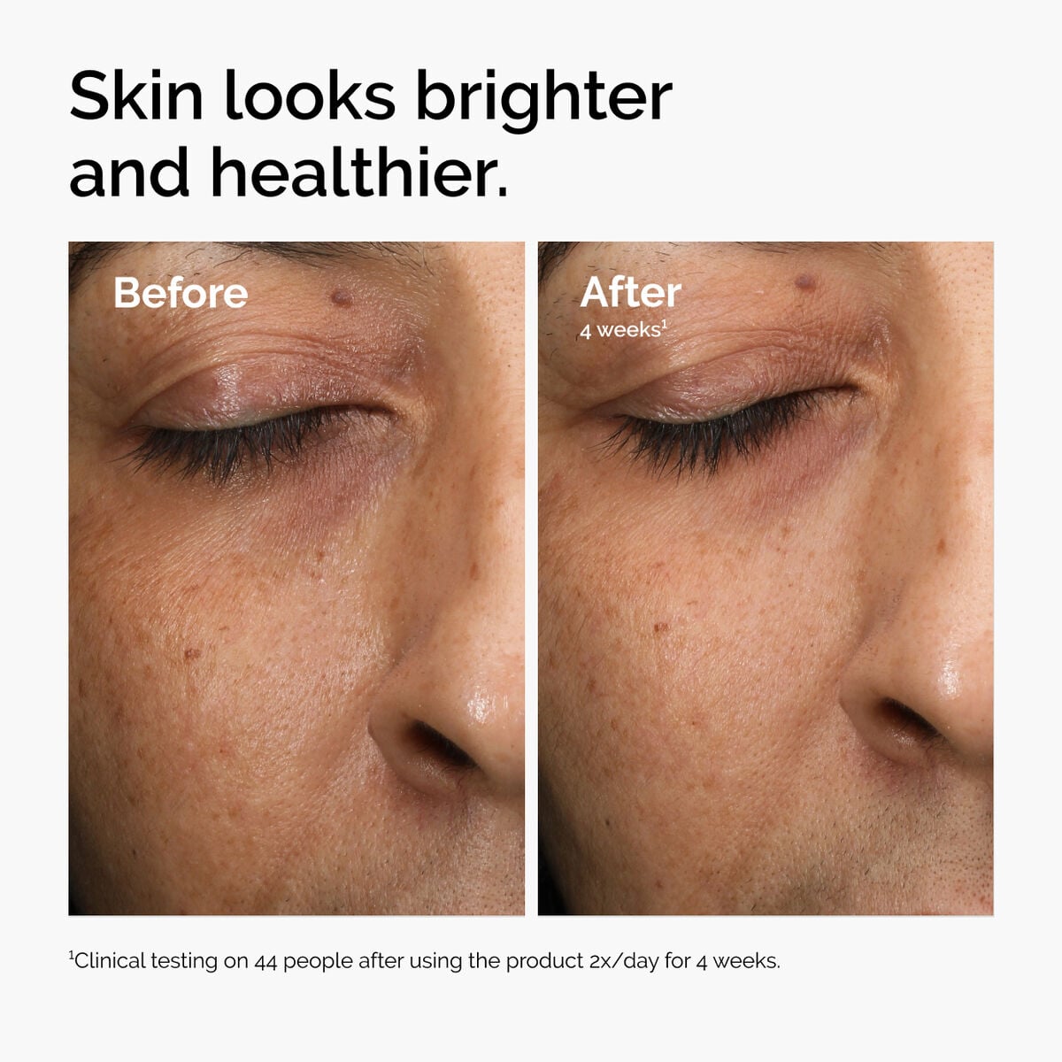 multi-antioxidant-radiance-serum-b4 ord-mars-before-after-healthy.jpg
