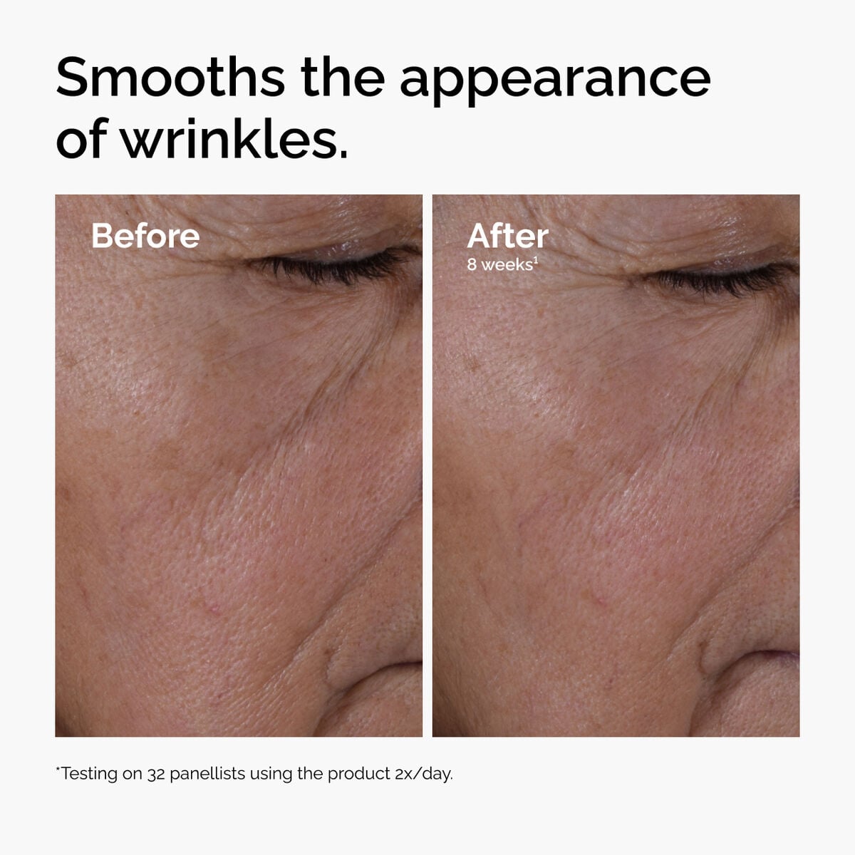 multi-peptide-ha-serum-r0 ord-multi-peptide-ha-serum-wrinkles-before-after.jpg