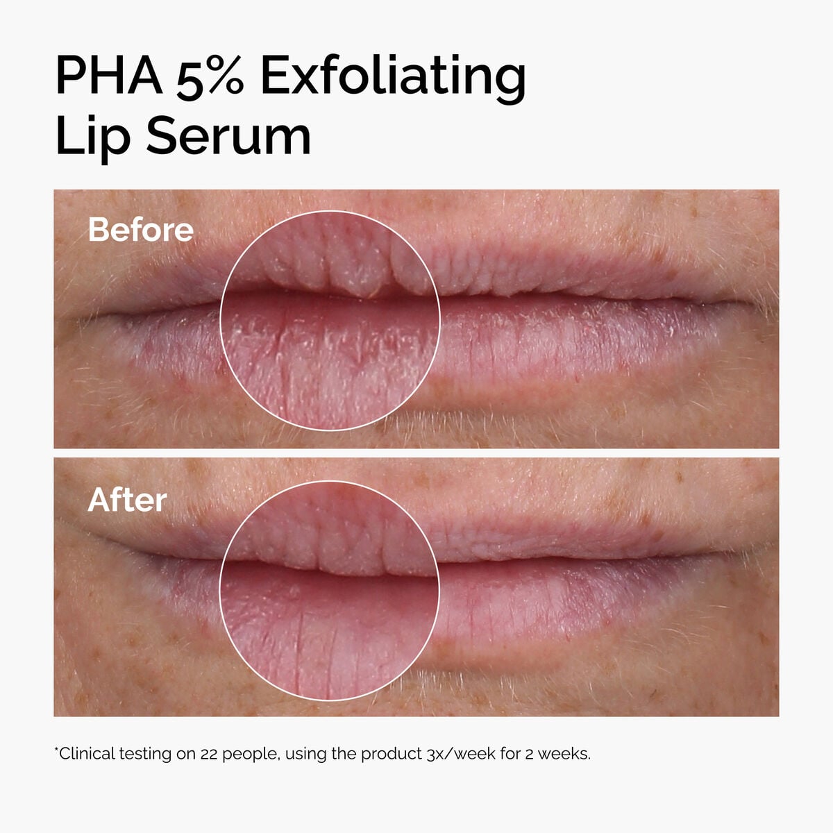 pha-5-exfoliating-lip-serum-j5 ord-pha-5pct-lip-exfoliating-serum-before-after.jpg