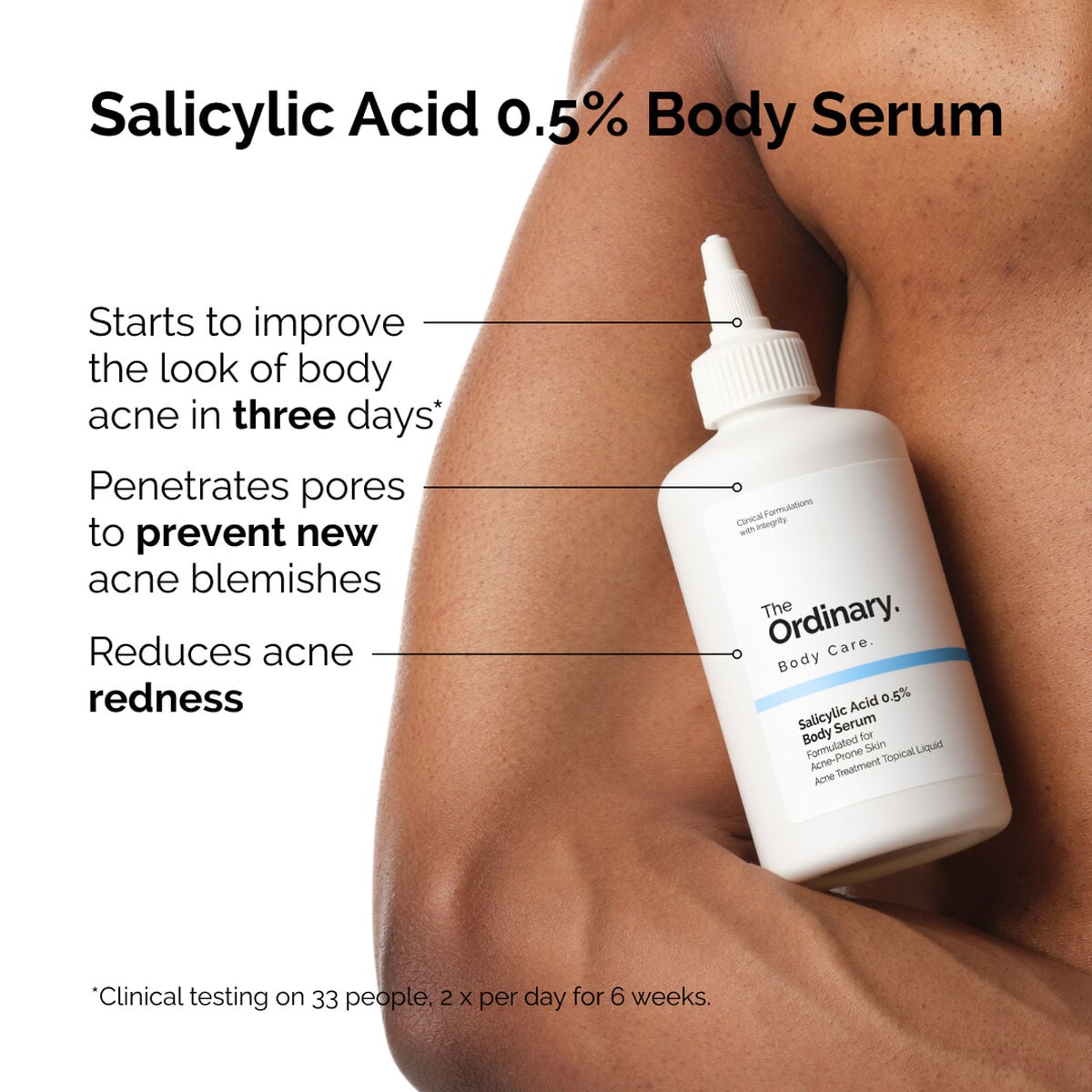salicylic-acid-0-5-body-serum-m5 ord-salicylic-05-body-serum-otc-benefits-infographic.jpg